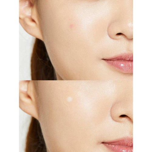 Cosrx Acne Pimple Master Patch